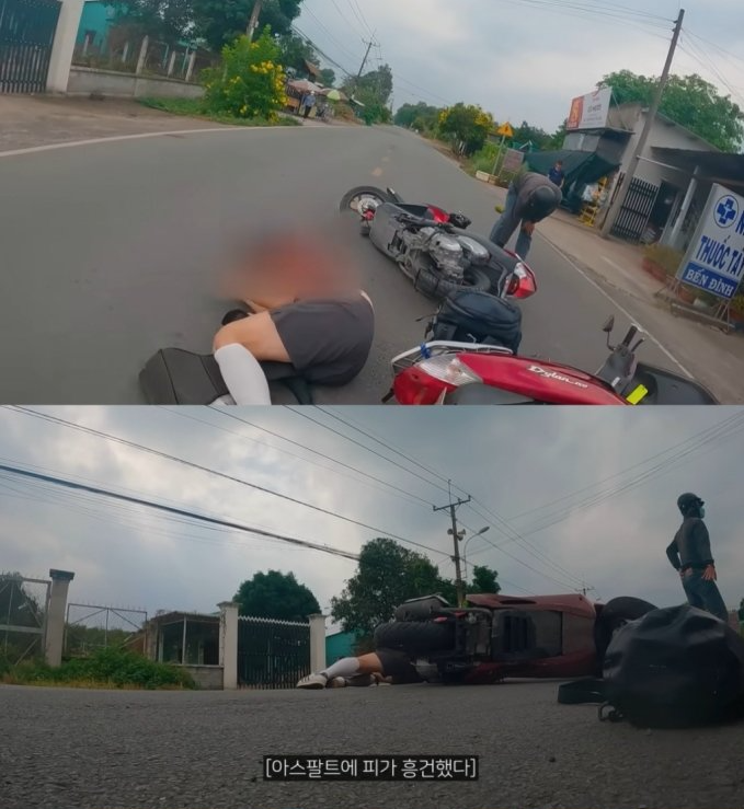 노홍철이 베트남에서 갑작스레 오토바이 사고가 나서 부상을 입었다. / 유튜브 '빠니보틀' 채널 캡처