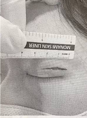 김경진의 눈 상처 / 스포츠 투데이 